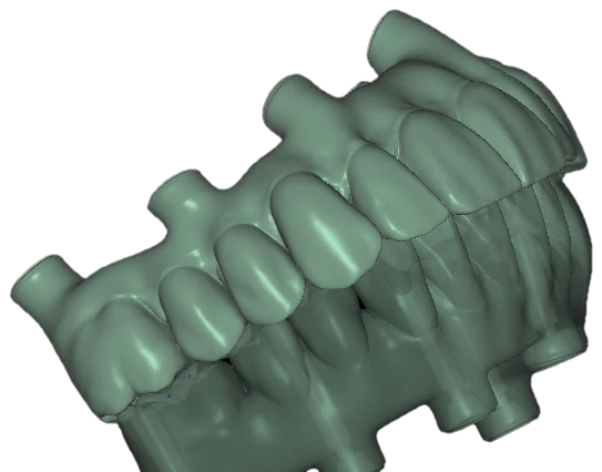 Upper and lower arch designs on cylindrical components.