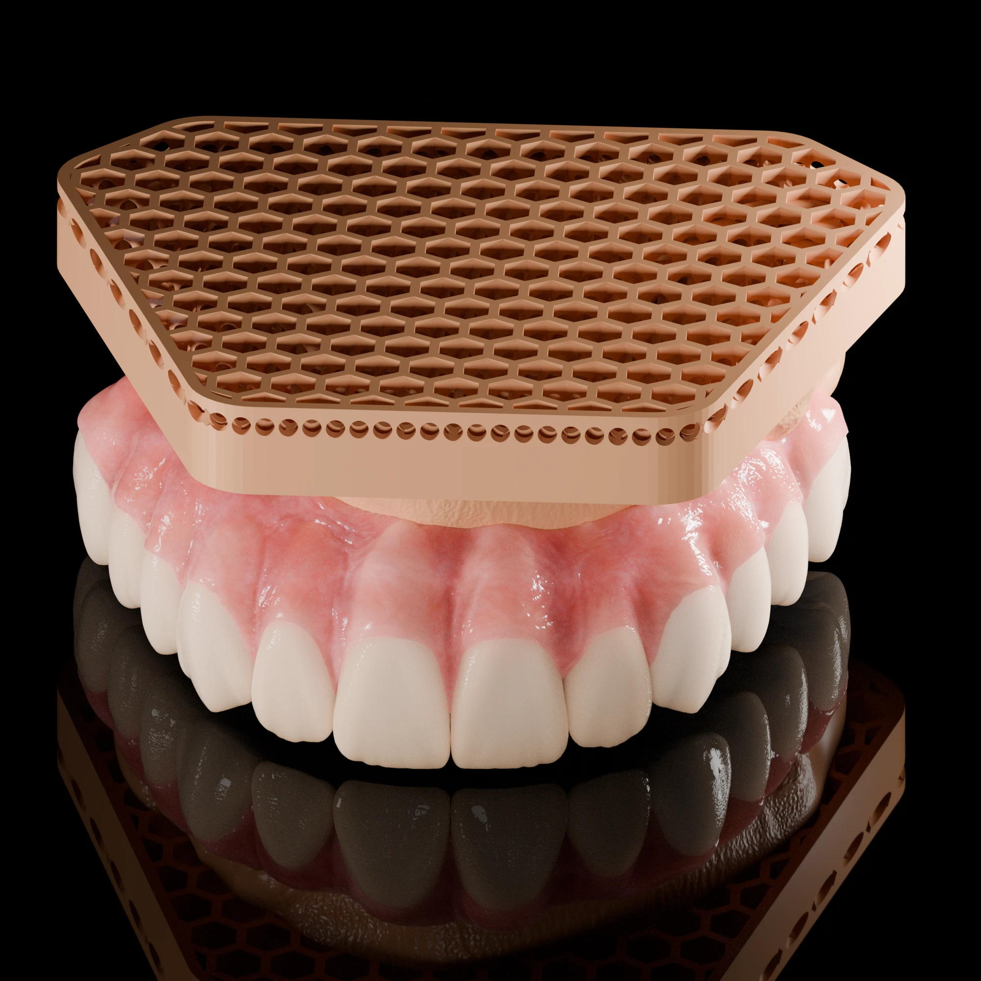 Photorealistic full-arch prosthesis with a honeycomb framework floating above, studio render
