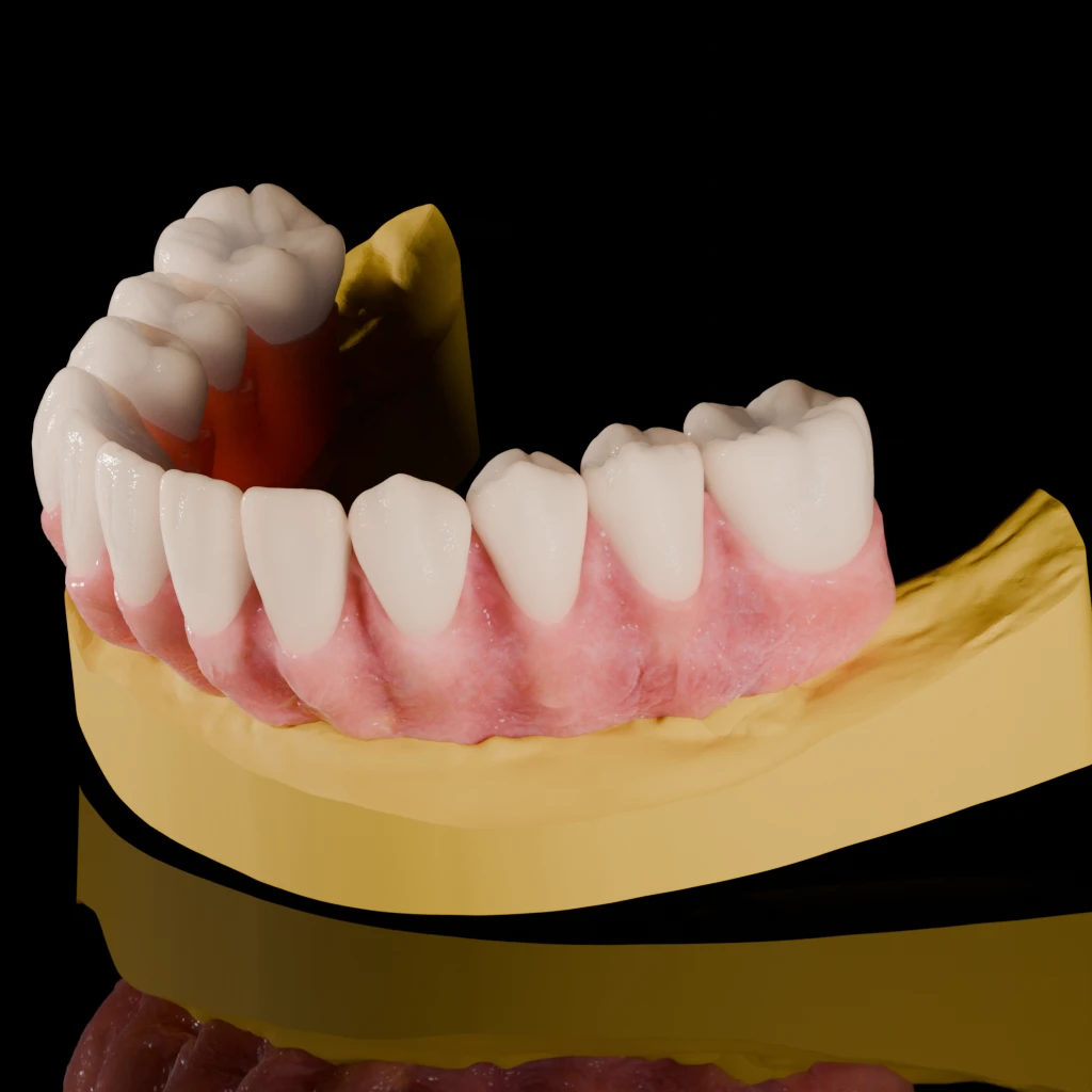 Photorealistic render of a lower arch on a gold model, three-quarter view from above, reflective floor