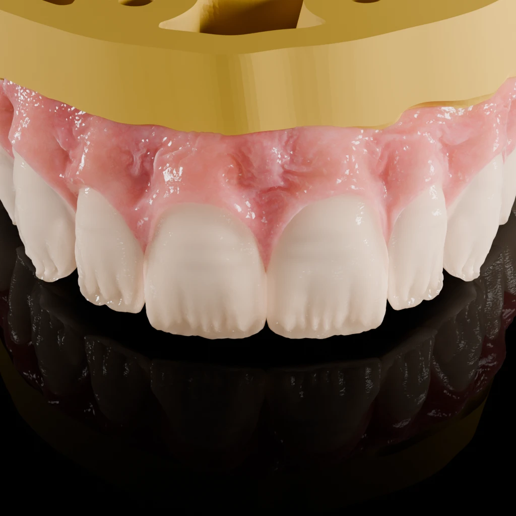 Macro of anterior teeth with a gold framework above, studio render