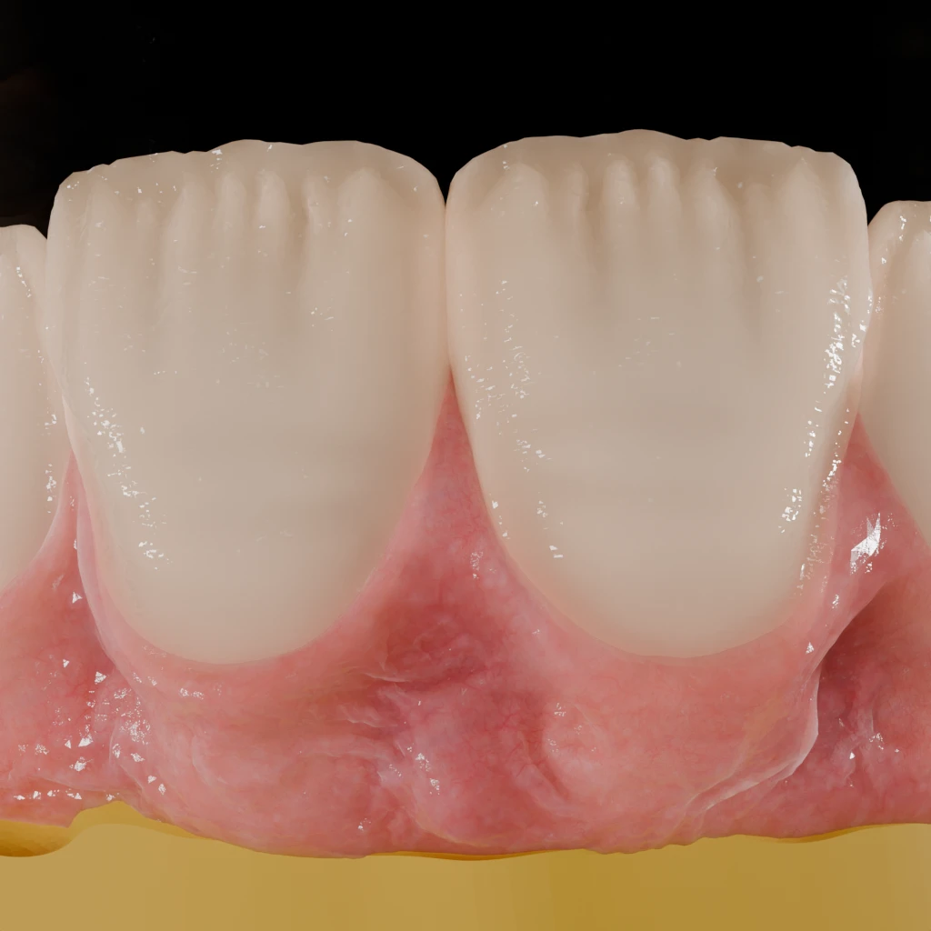 Photorealistic extreme macro of two central incisors with textured gingiva