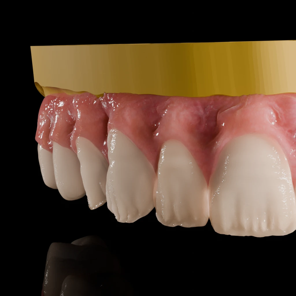 Photorealistic side macro of the upper front tooth row on a gold model base
